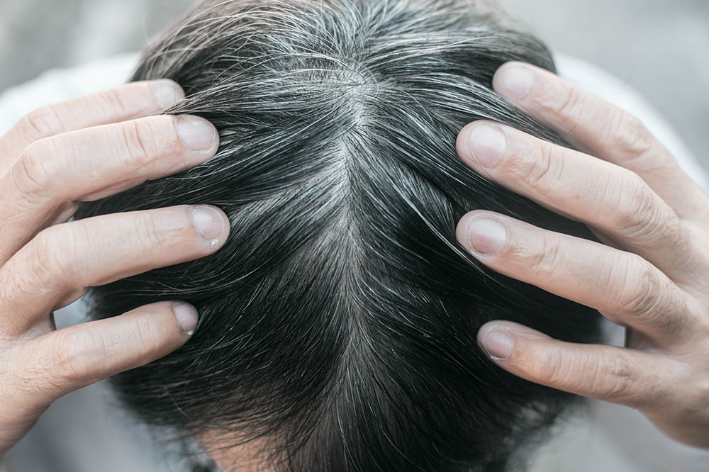 6 home remedies for graying hair