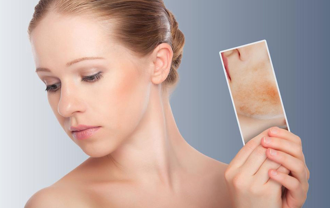 6 things you should not do if you have skin rash