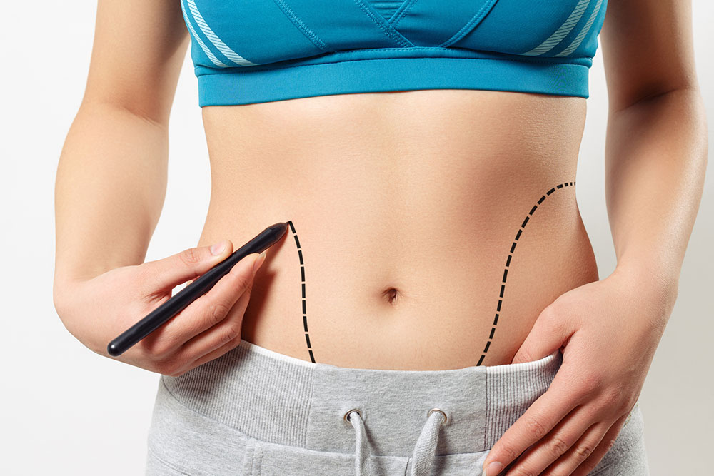 Abdominoplasty – Procedure, cost, pros, and cons