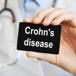 Crohn’s disease – Causes, symptoms, and management options