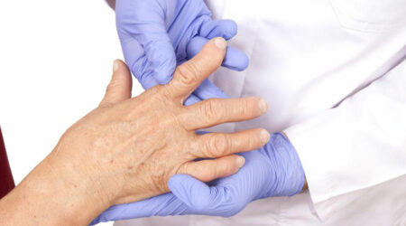 4 best remedies for rheumatoid arthritis 