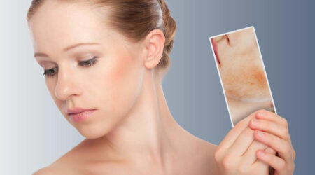 6 things you should not do if you have skin rash