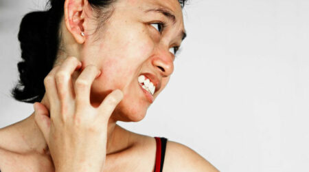 A few common types skin rash that affects people