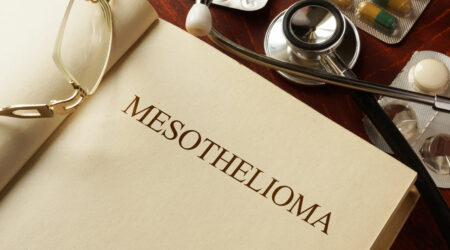 All you need to know about mesothelioma and its symptoms