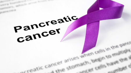 Symptoms of pancreatic cancer