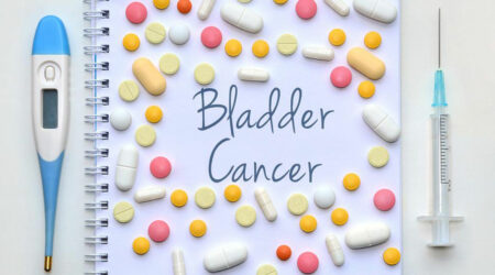 Things to know about the different stages of bladder cancer