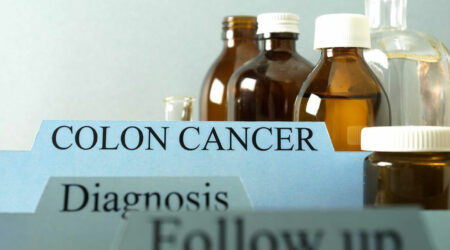 Things you need to know about colon cancer