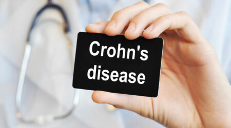 Crohn&#8217;s disease &#8211; Causes, symptoms, and management options