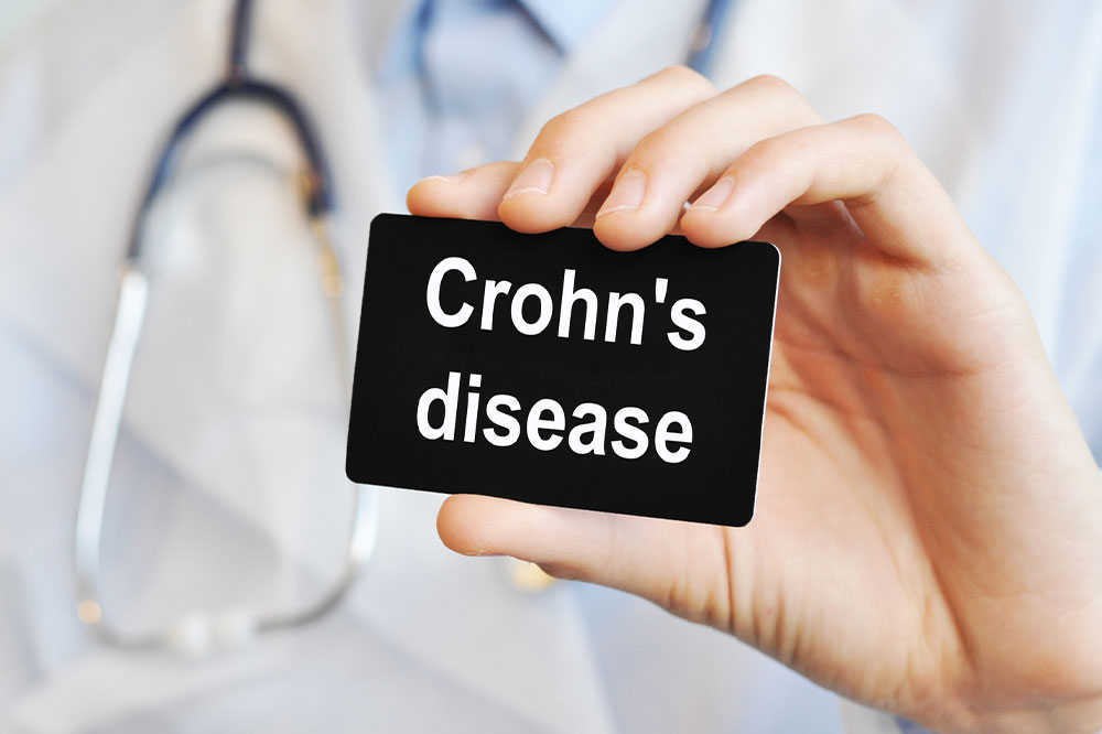 Crohn&#8217;s disease &#8211; Causes, symptoms, and management options